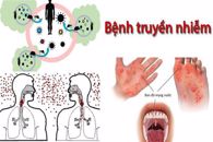 Triển khai hoạt động phòng, chống các bệnh truyền nhiễm nguy hiểm